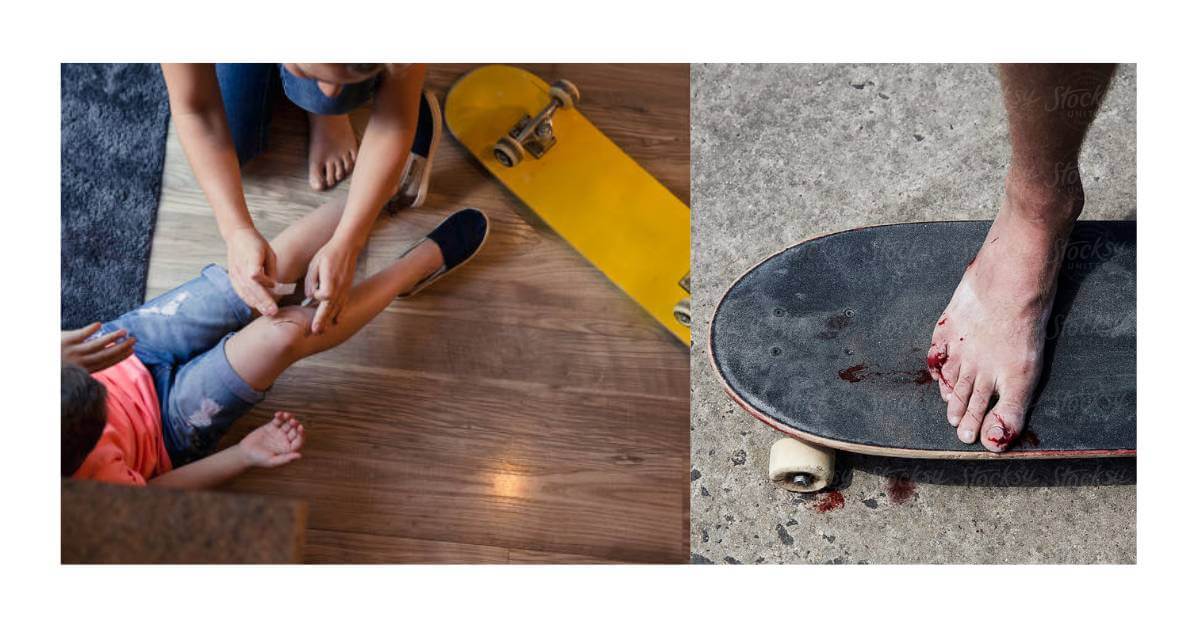 The Science Behind Knee Injuries In Skateboarding