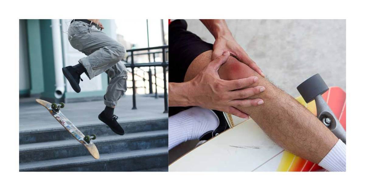 Understanding Knee Rehabilitation And Recovery